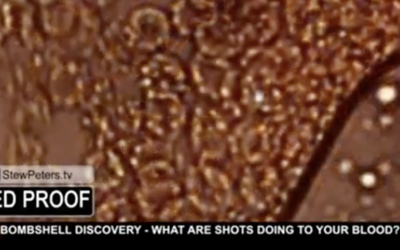 COVID Vaccine Fingerprints Being Found in Recent Autopsies Globally – Dr Peter McCullough