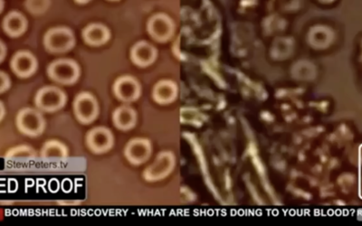 COVID Vax Contains Graphine Oxide confirmed, thickening of blood, side by side microscope images.