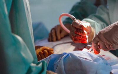 Invasion of the Body Snatchers! The Myth of Being “Brain Dead” All for Organ Harvesting! They Primarily Focus on People Overdosing So They Can Steal LIVING Organs!